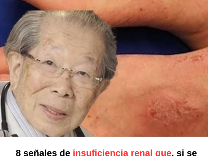 8 señales de insuficiencia renal que, si se ignoran, pueden requerir diálisis de por vida