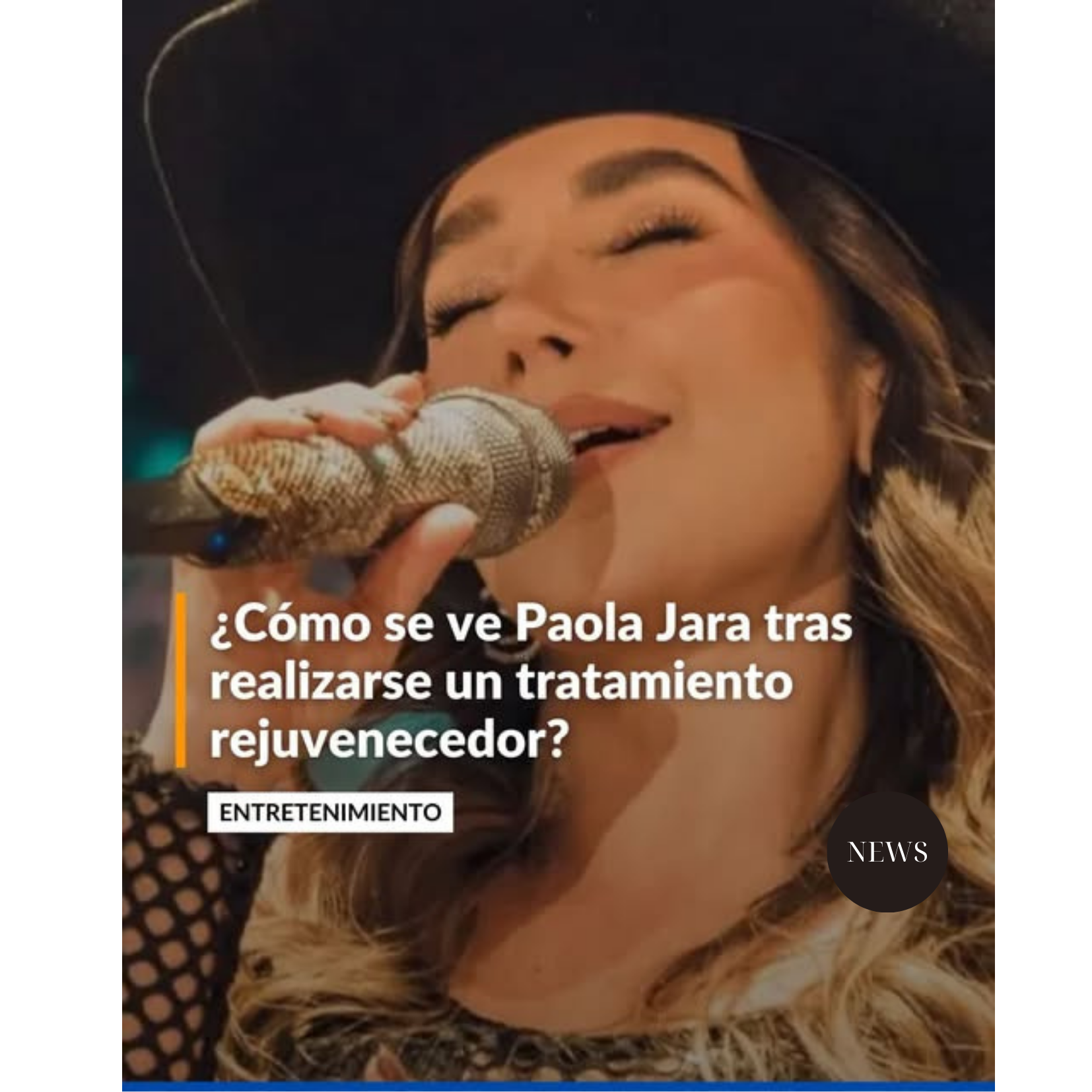 Así luce Paola Jara después de someterse a un tratamiento rejuvenecedor: “Me siento feliz”